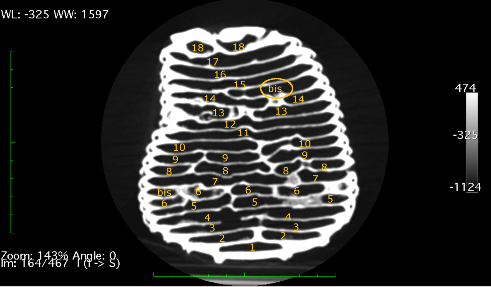 Apicotermes nest (probably Apicotermes lamani). The numbers highlight the different layers inside the nest. The appearance of helicoidal ramps corresponds with the formation of intermediate (bis) layers.