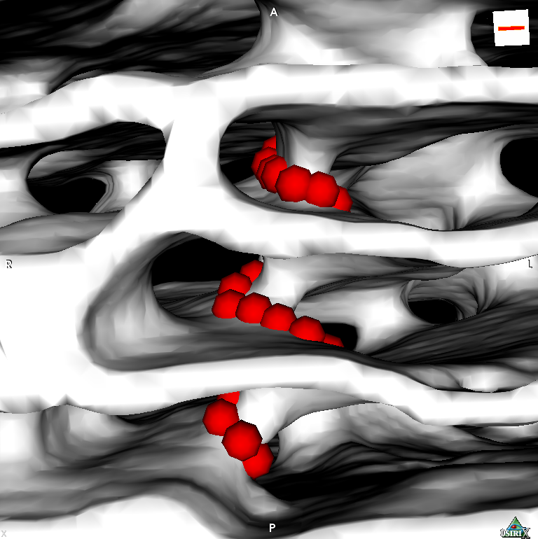 Helix inside an Apicotermes nest